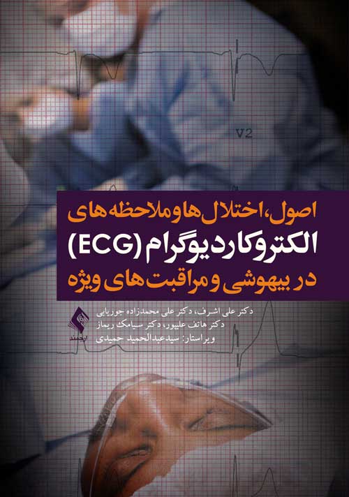 الکتروکارديوگرام (ECG) در بيهوشي و مراقبت هاي ويژه